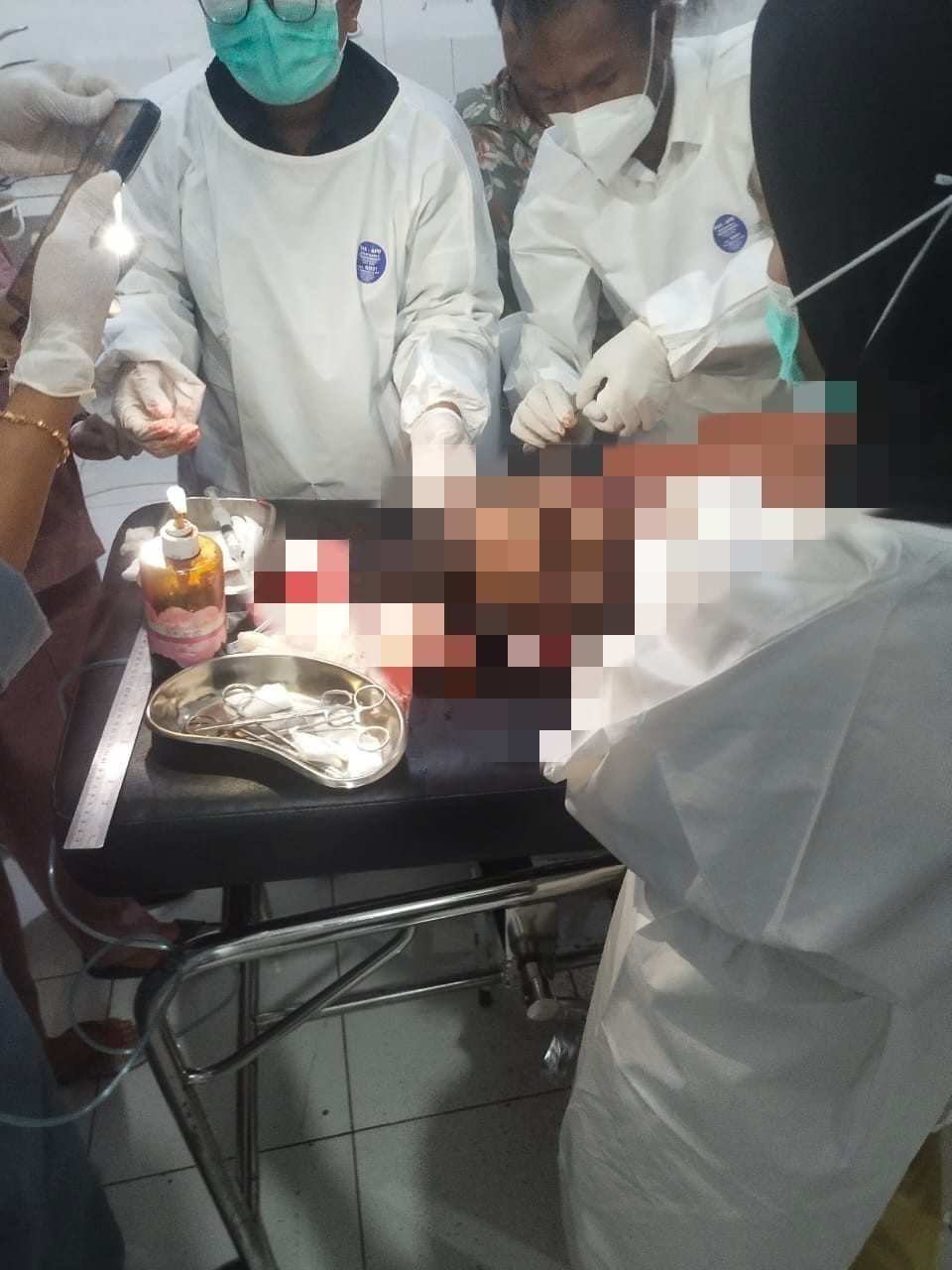 Lagi! Warga Sipil Jadi Korban penganiayaan dengan menggunakan senjata tajam di Yahukimo, Diduga Dilakukan KKB